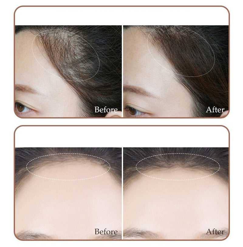3 in 1 Hairline & Eyebrow Shaping Stamp